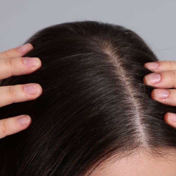 30% Off Your First Trichology Appointment With Sarah 30% Off Your First Trichology Appointment With Sarah